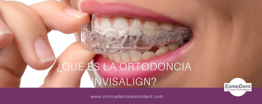 que es la ortodoncia invisalign