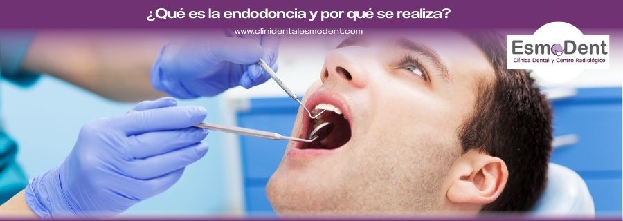 Qué es la endodoncia y por qué se realiza